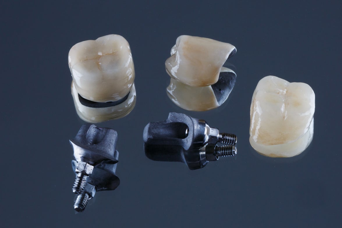 Crowns and Titanium Base for Fixing